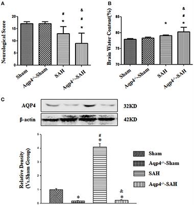 The Involvement of Aquaporin-4 in the Interstitial Fluid Drainage Impairment Following Subarachnoid Hemorrhage